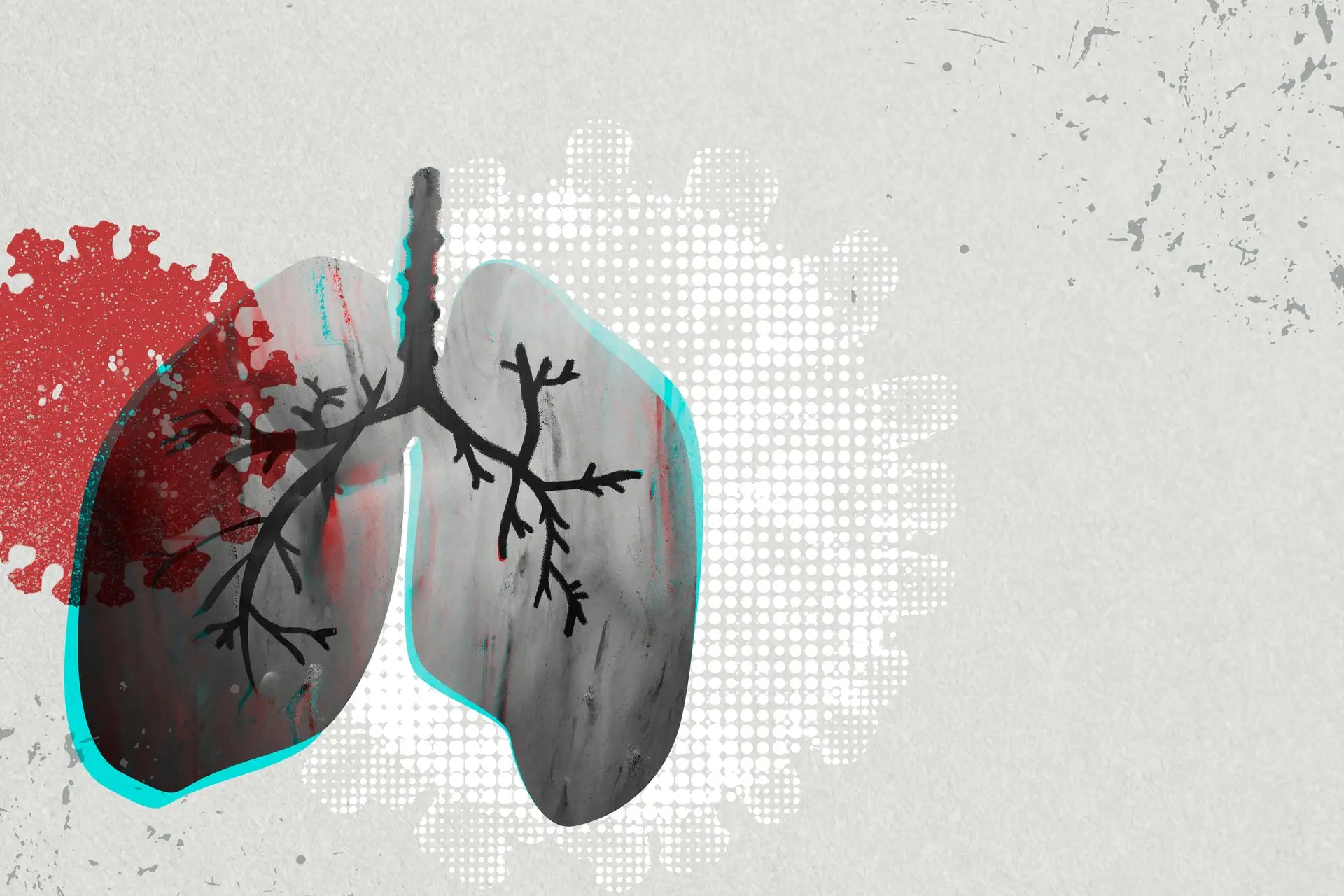 International Association for Paratuberculosis